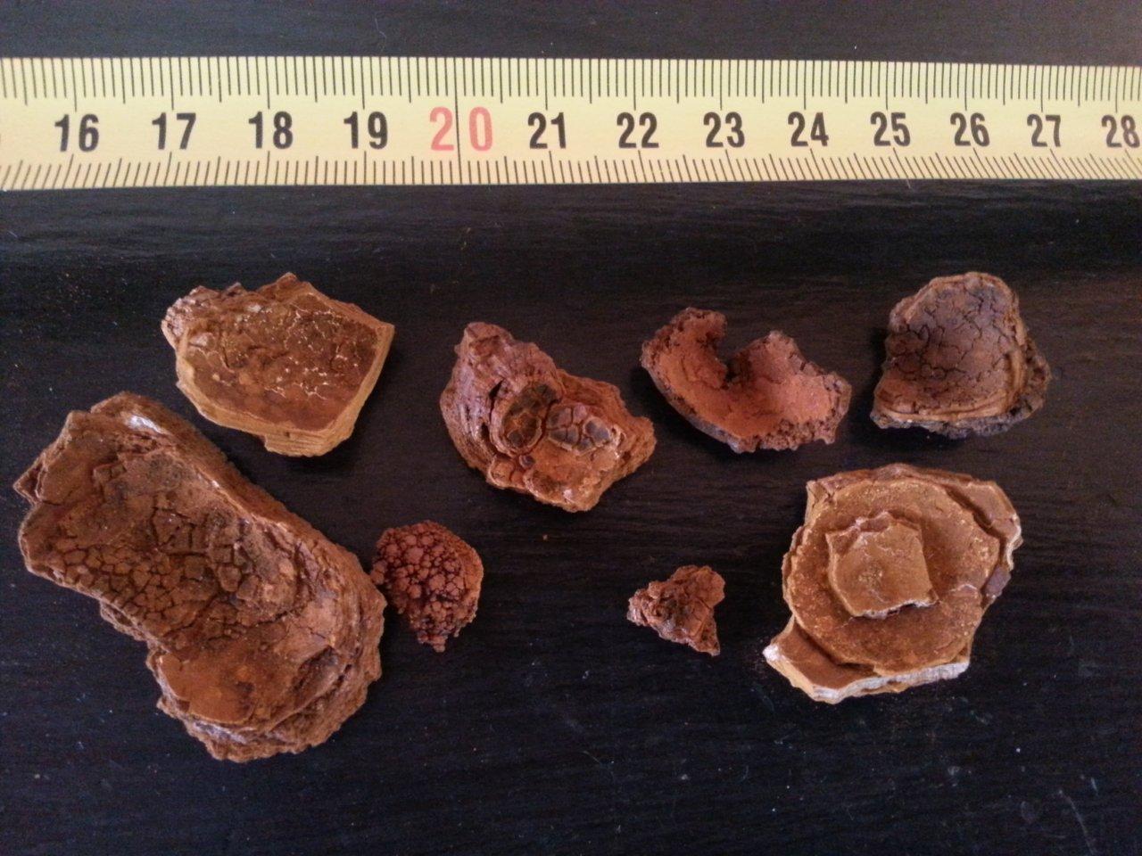 Gallstones with various shapes