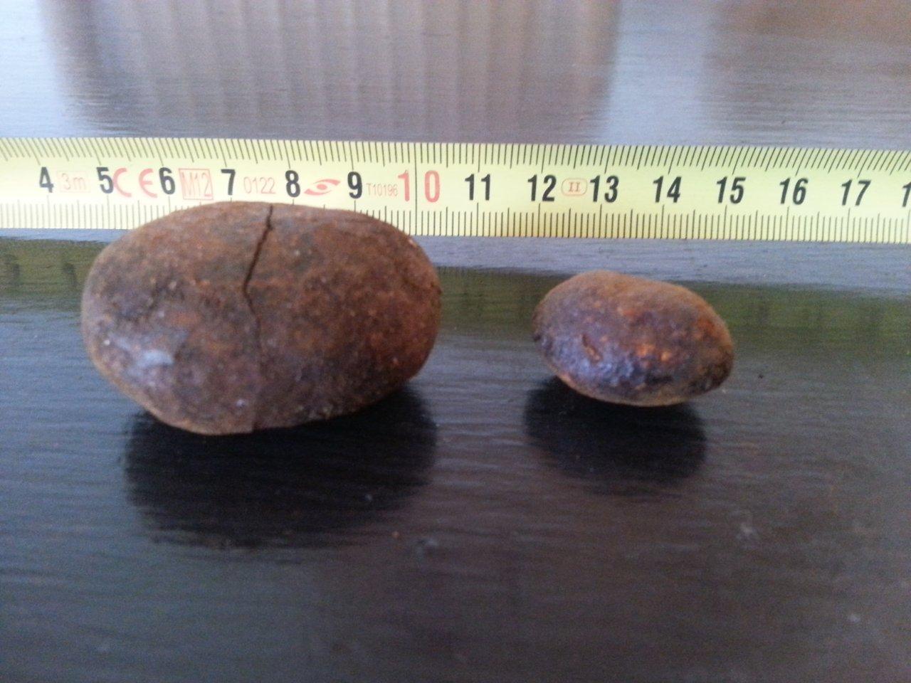 Gallstones bearing various colours